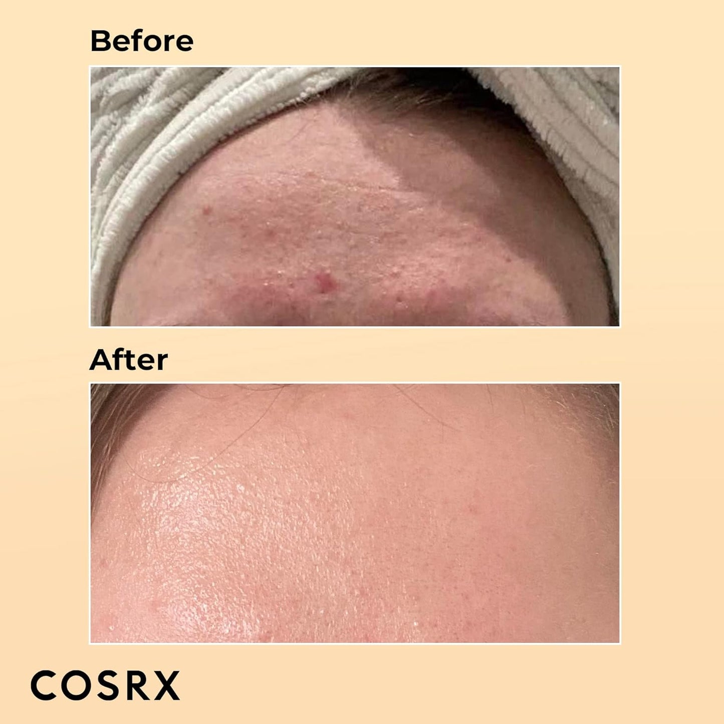 Cosrx - Advanced Snail 96 Mucin Power Essence 100ml - KOREAN SKINCARE